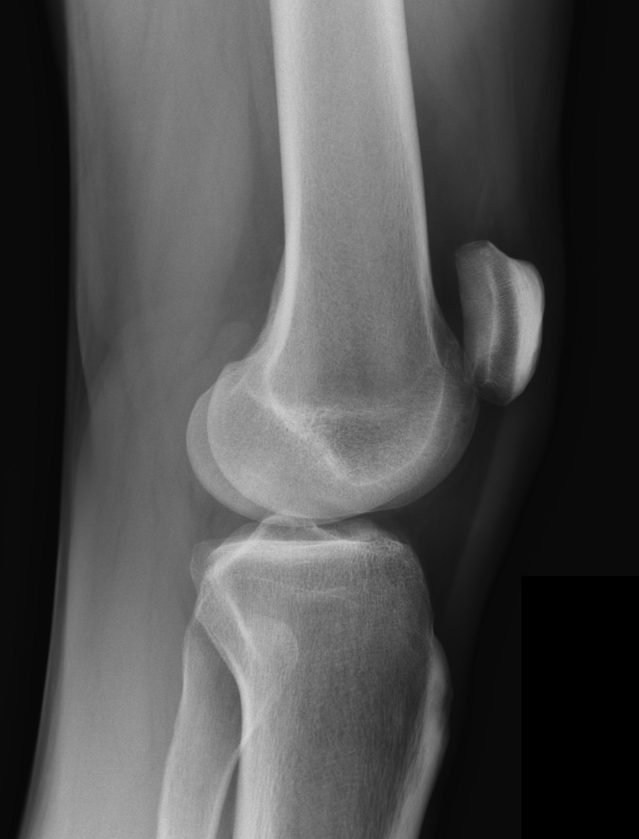 Knie lateral